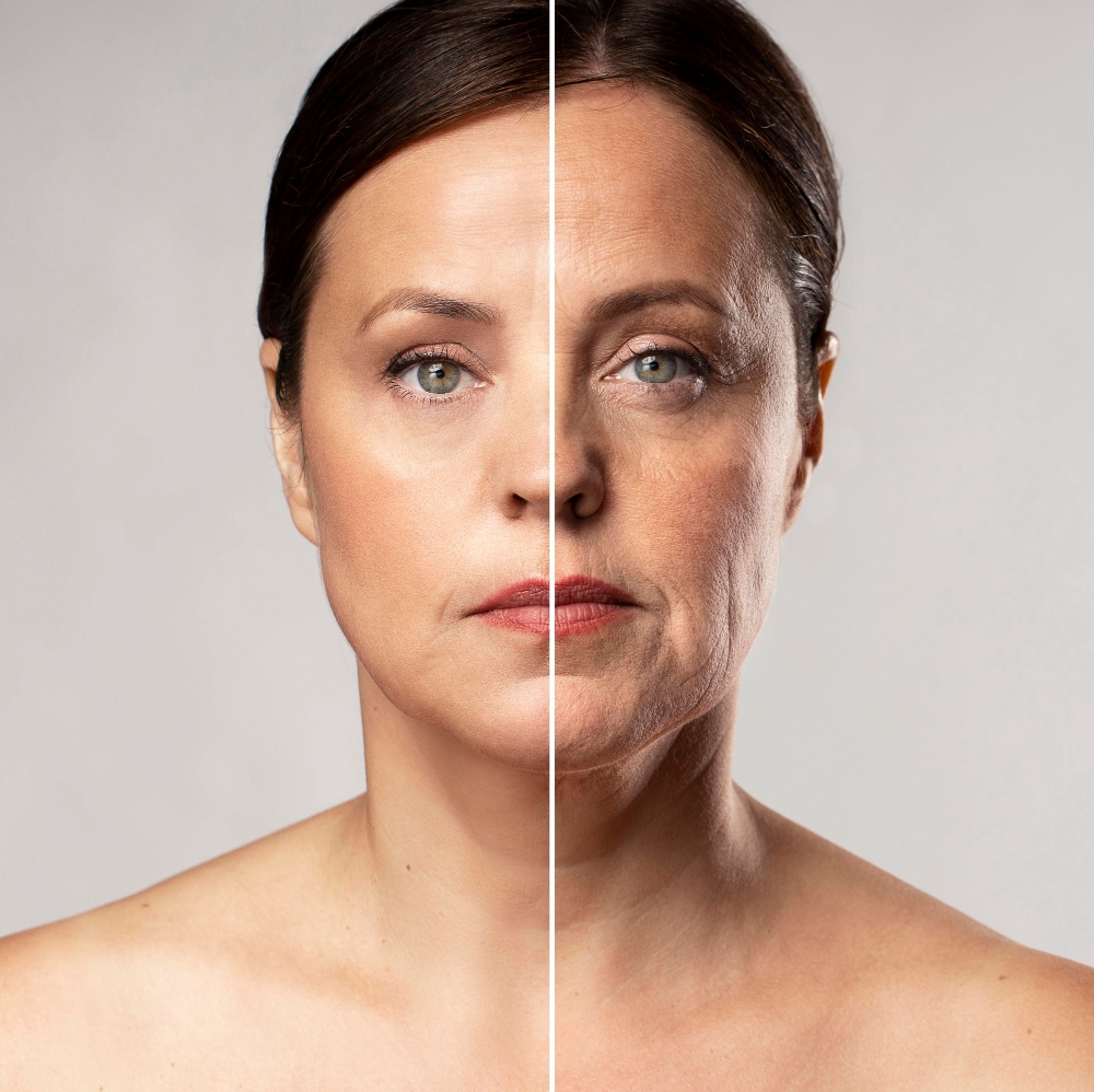 Full Face Anti Wrinkle Treatment
