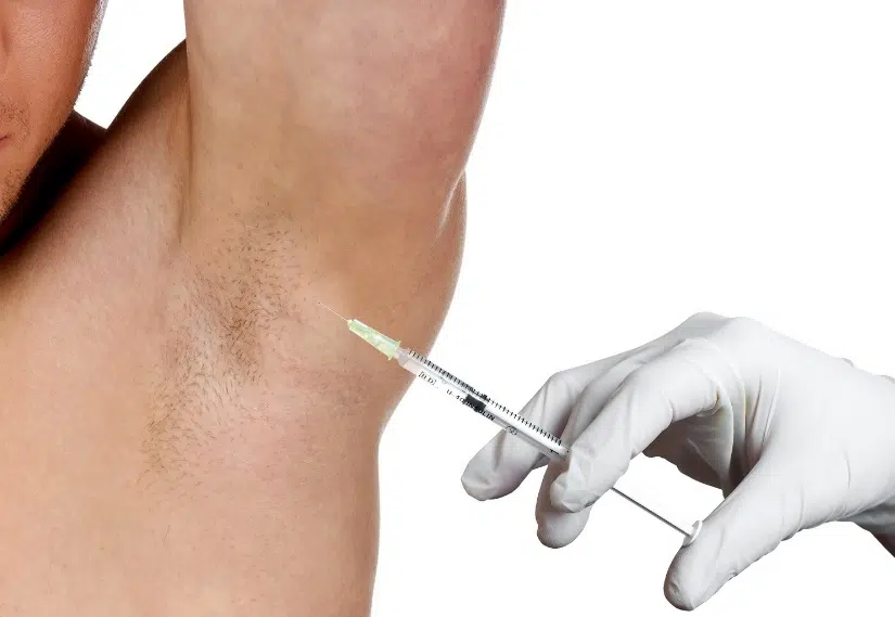 Armpit Hyperhidrosis Treatment img-1