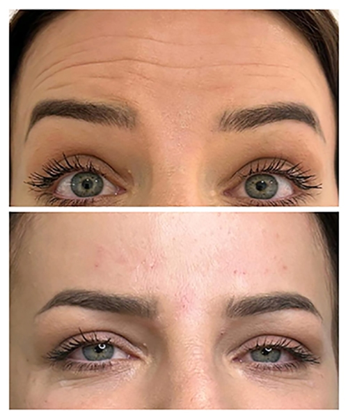 How the Treatment Works