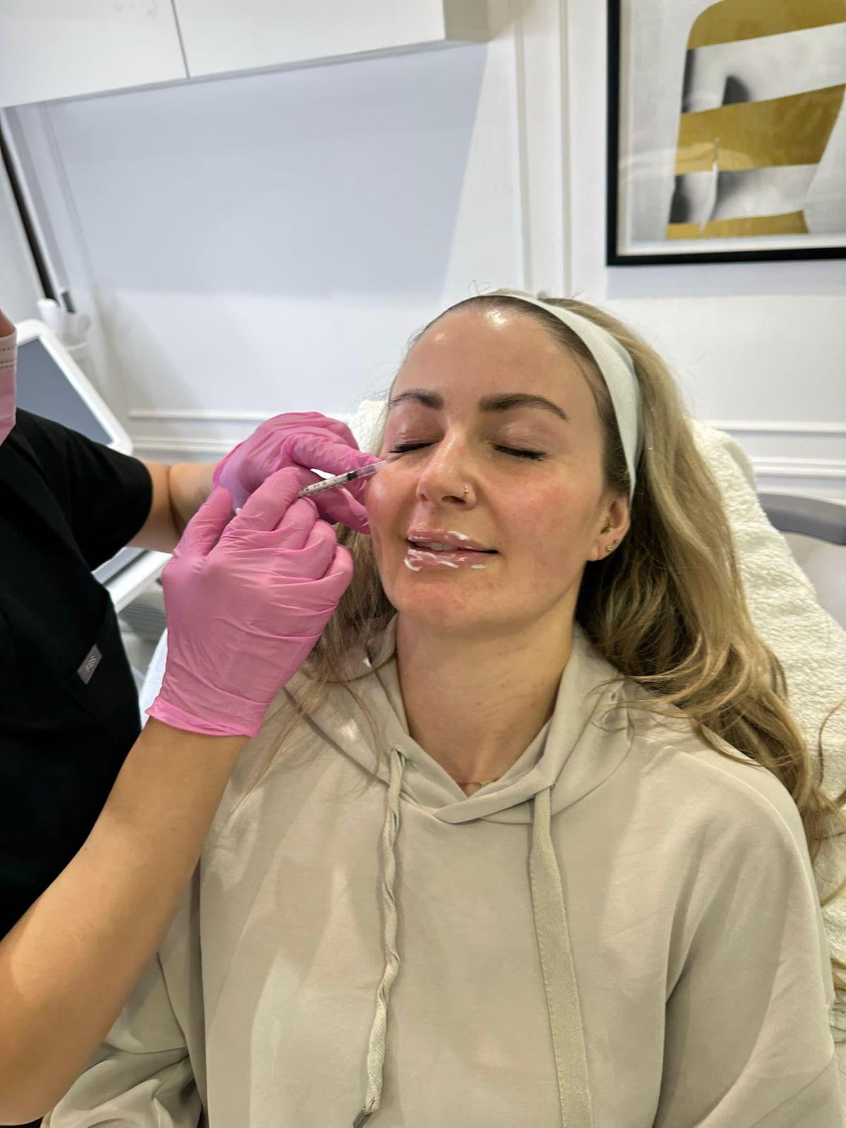  Anti-Wrinkle 1-2-3 Zone Treatment